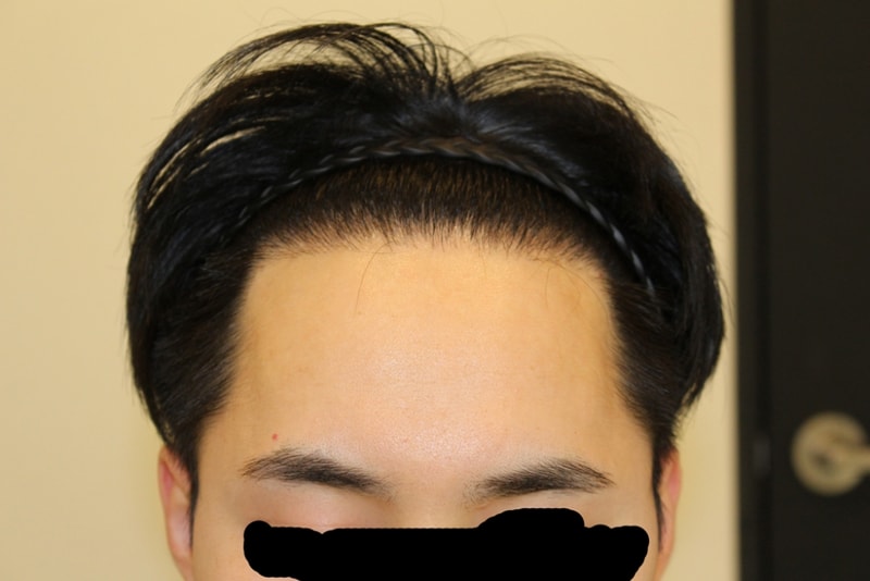 수술후1.jpg