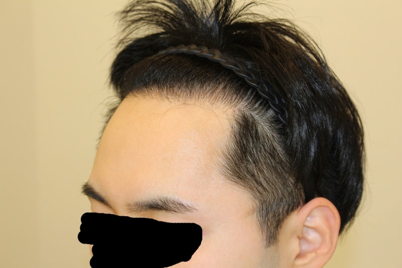 수술후2.jpg