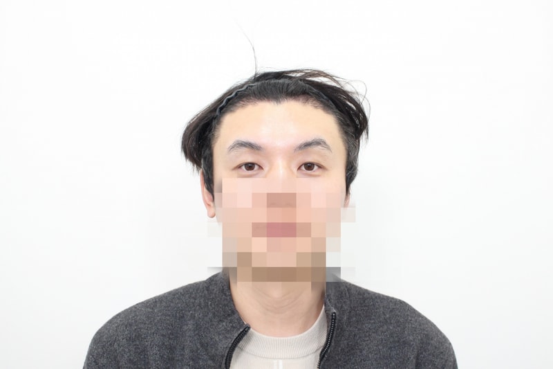 18일차 내원사진-3.jpg