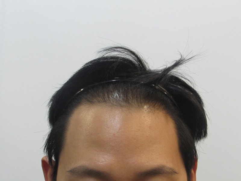 1년 10개월 6.png
