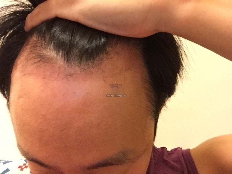 50일 암흑기 절정.JPG