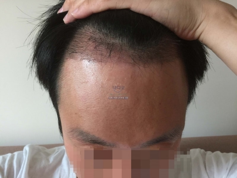 77일 솜털 굵어짐.JPG