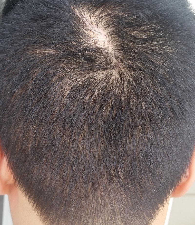 Extracted back.jpg