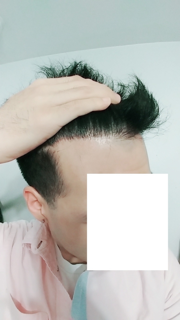 옆.jpg