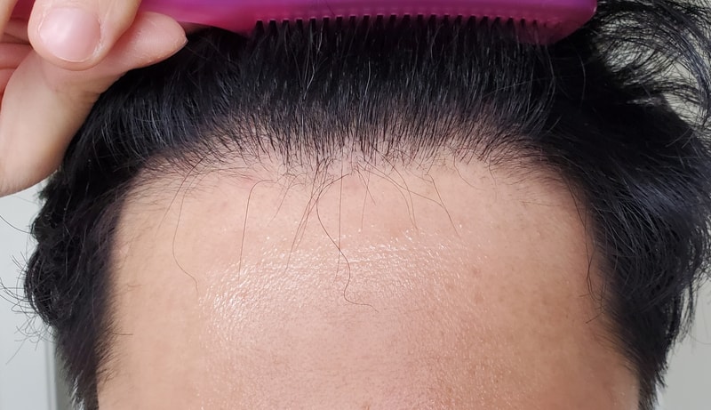 Front combed.jpg