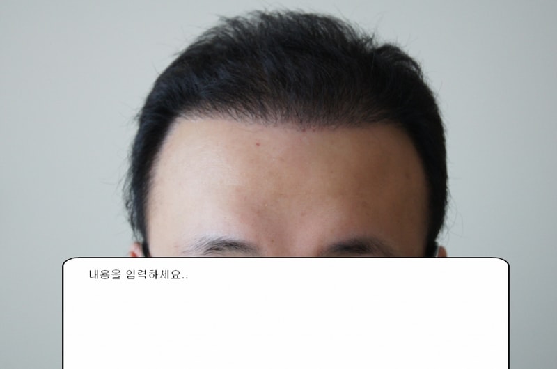 정면 수술후.JPG