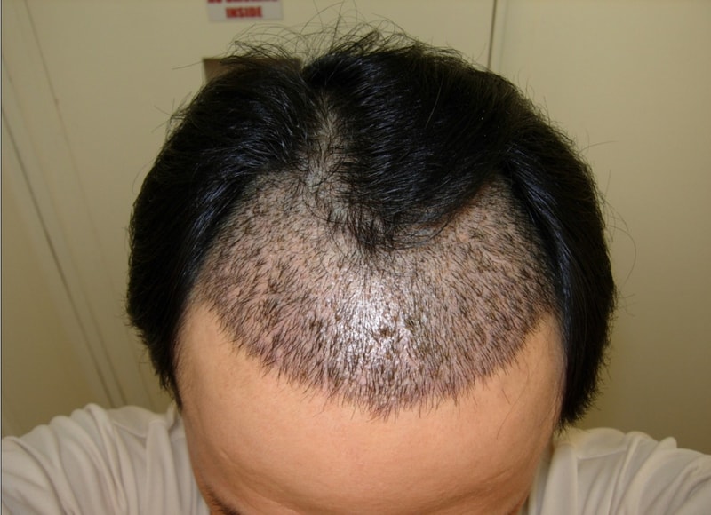 수술후2.jpg