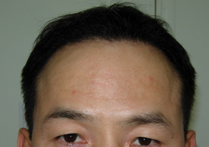 4개월6.jpg