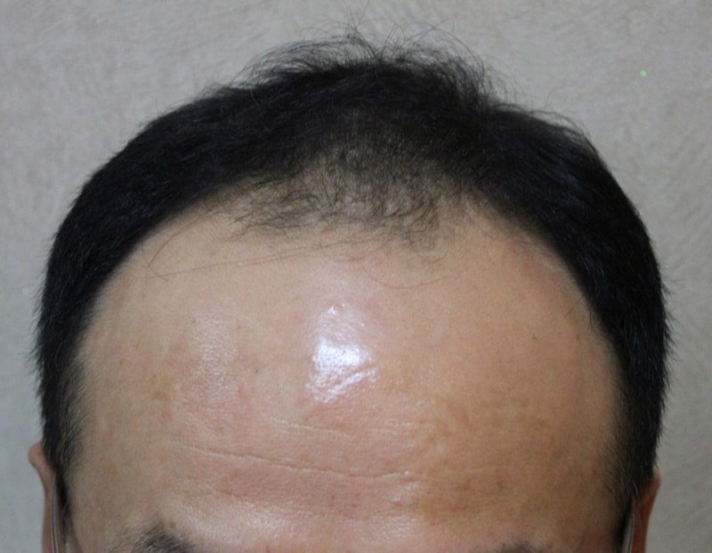 수술전 1.jpg