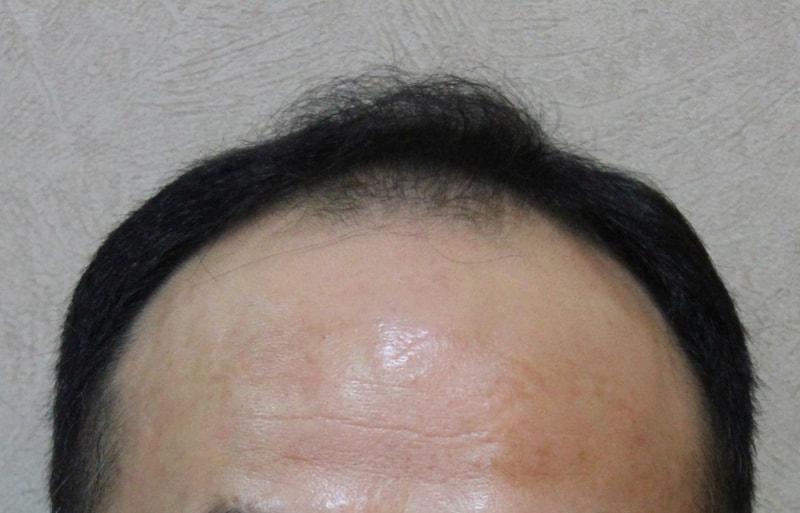 수술전 2.jpg