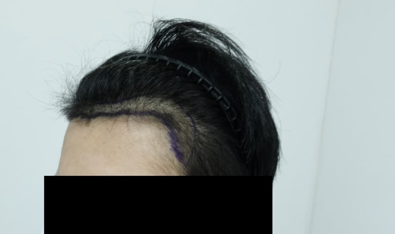 전 왼쪽.jpg