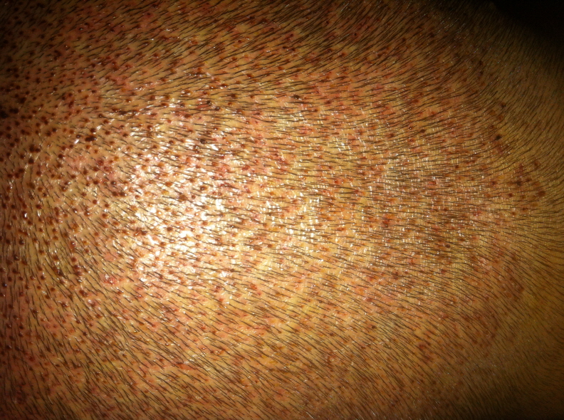 꾸미기_12IMG_2565.JPG