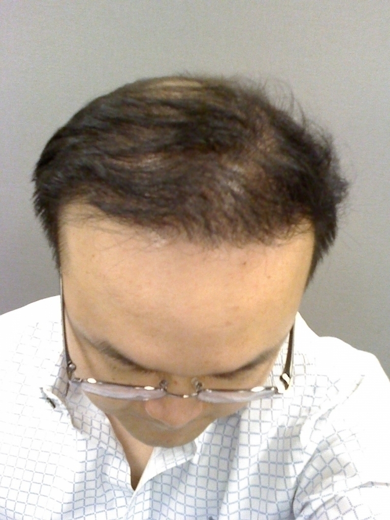 Month06-Top2.jpg