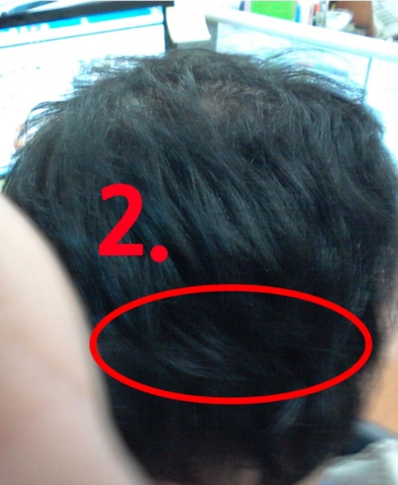 5. 2주후_뒤.jpg