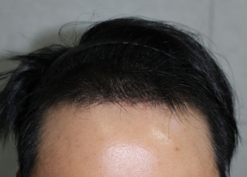 후 정.jpg