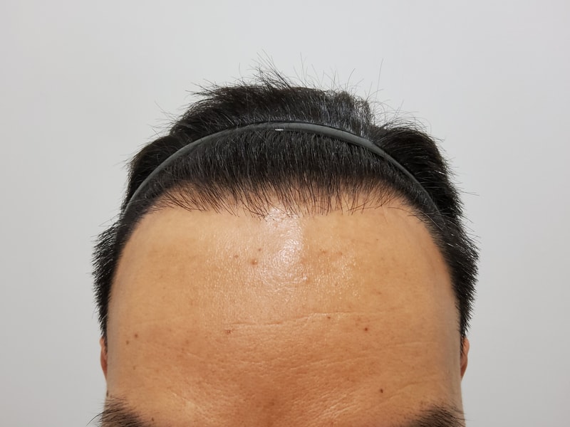 잔디들이 조금씩 나왔네요 3개월차입니다