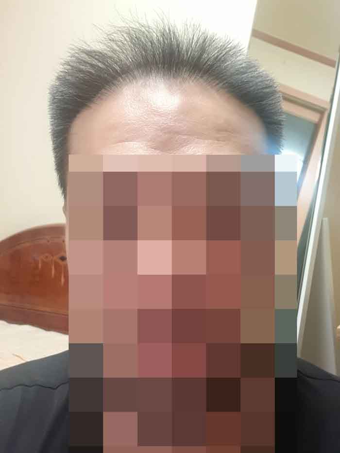 수술전1.jpg