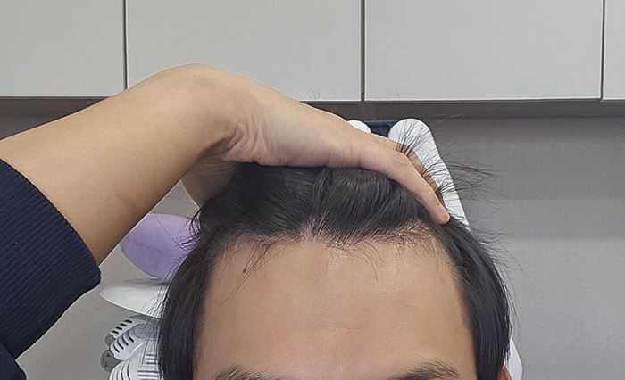 3. 2개월 정면.jpg