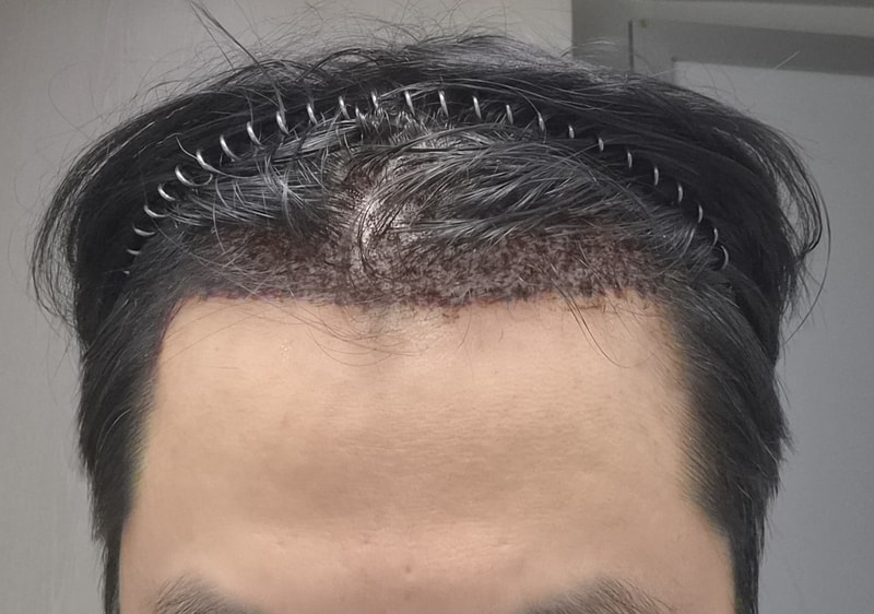 3일후.jpg