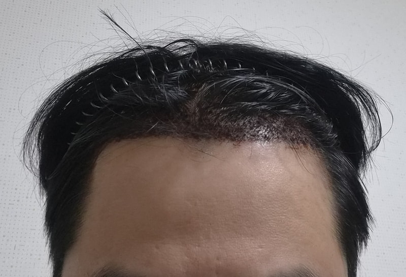 3일후2.jpg