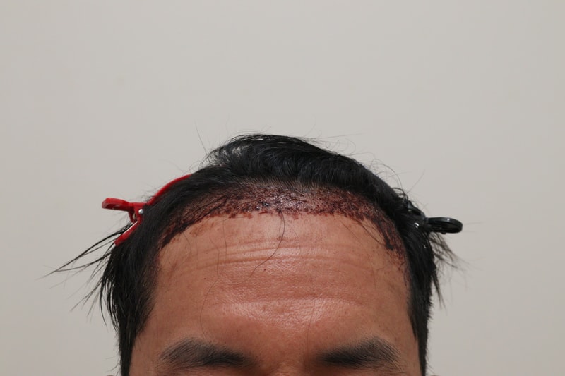 앞으로 자랄머리가 설렙니다 1일차입니다.