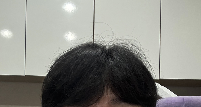 2. 평소 스타일 아직까진 암흑기라 머리 내리고 다닙니다. 지난달에 이발했는데 벌써 이만큼이나 자랐네요.jpg