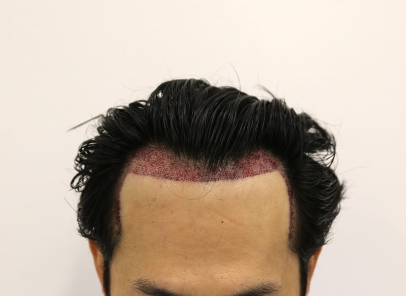1000045212.jpg