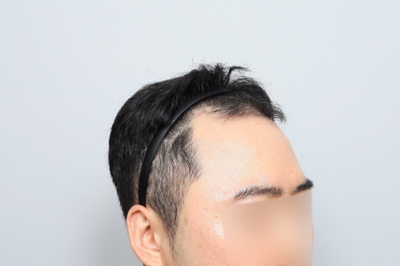 수술전-(8).jpg