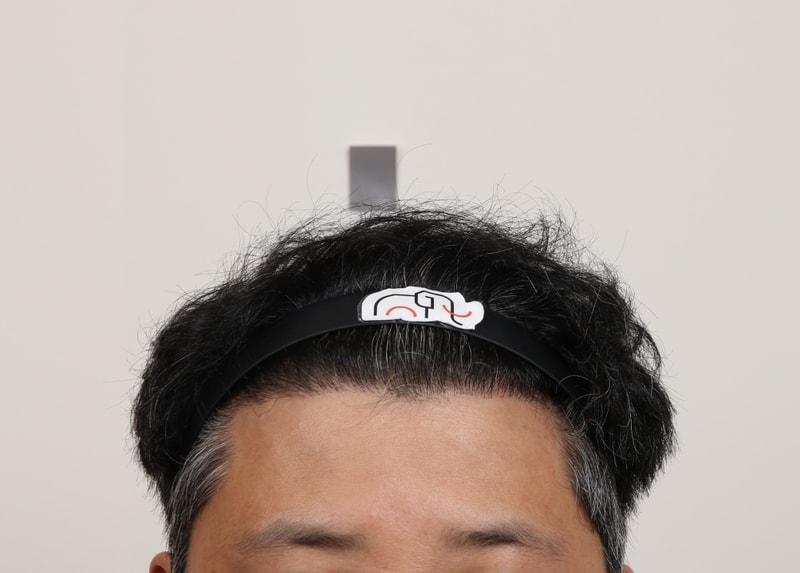 수술 경과 8개월 2.jpg