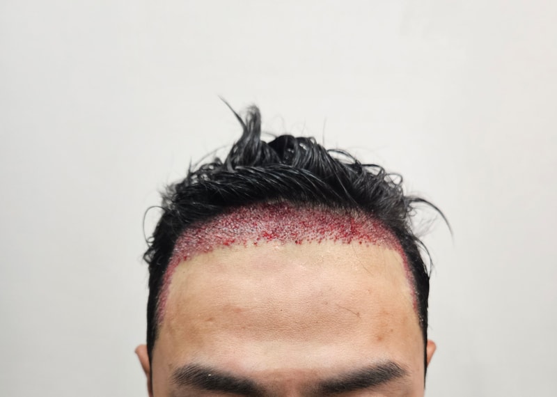 1000032031.jpg