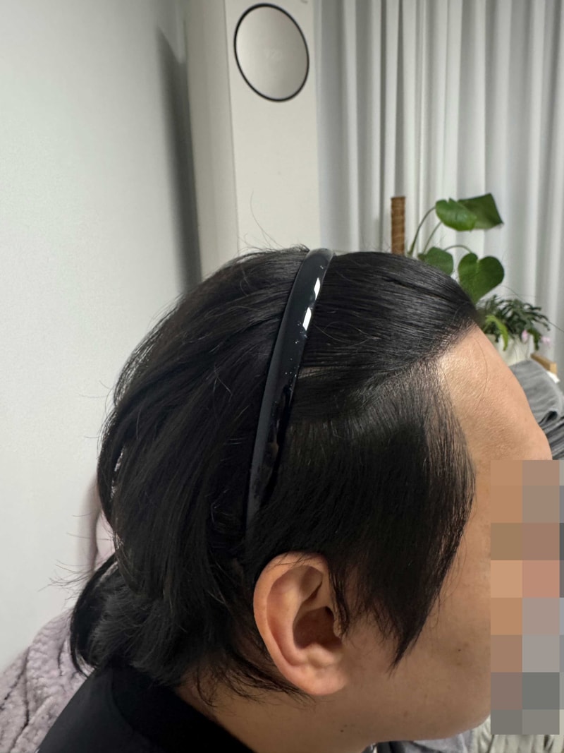 수술후1.jpg