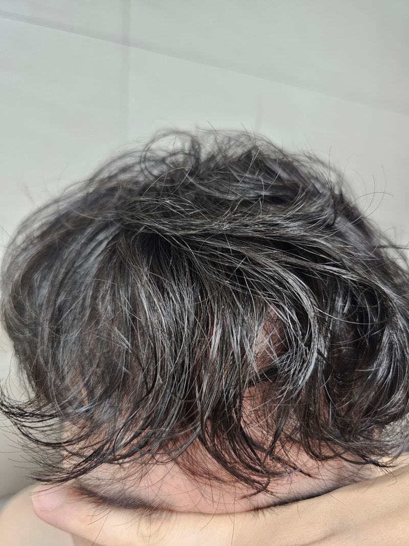 뉴헤어 3600모 9개월차 후기