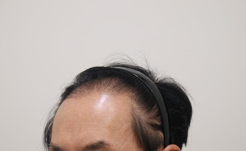 1. 수술전_2.JPG