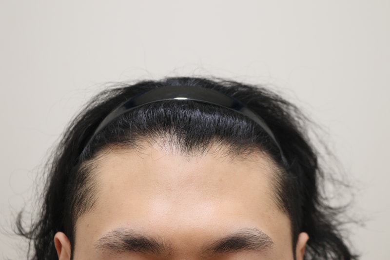 1. 수술전_1.JPG