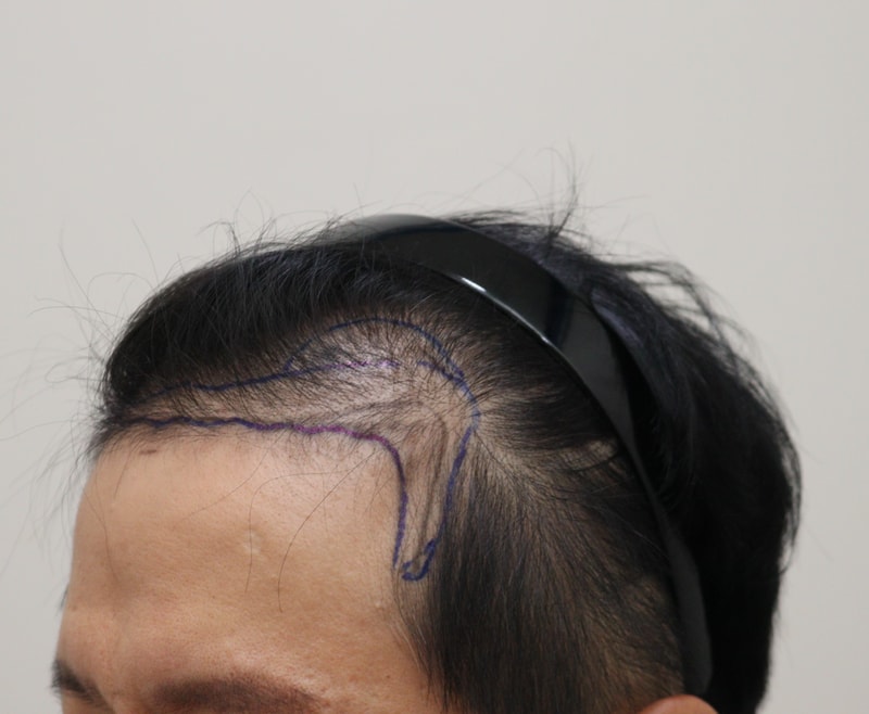 1. 수술전_2.JPG