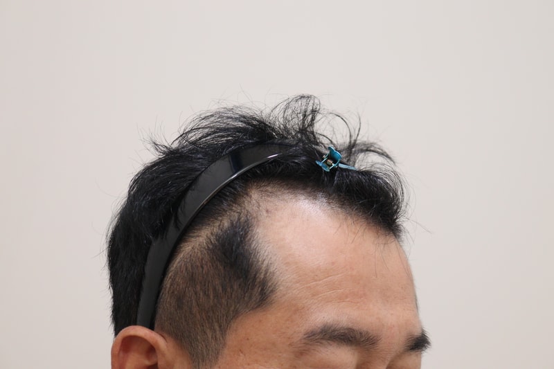 1. 수술전_3.JPG