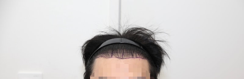2600모 1년 2개월 후기
