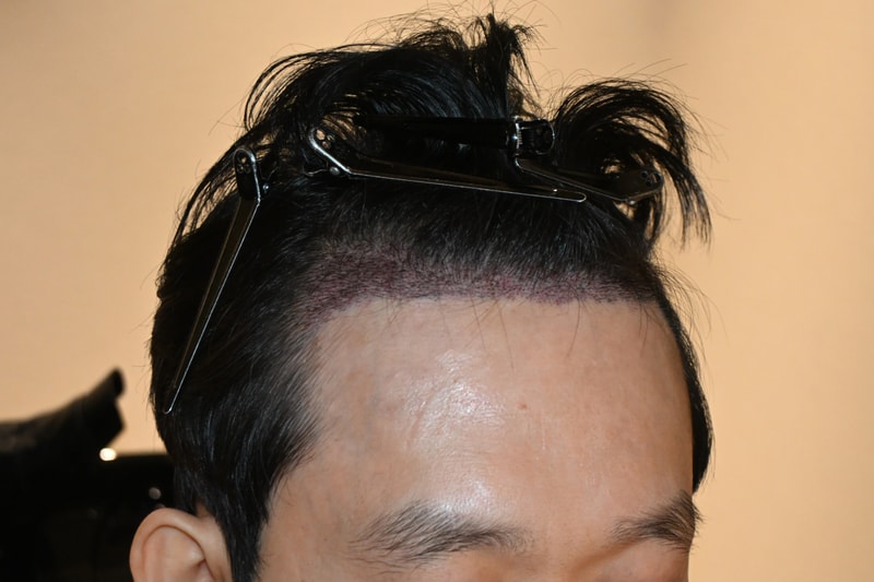 수술후 (1).jpg
