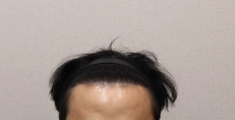 4. 2년4개월 경과.JPG