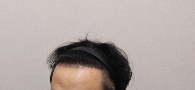 6. 2년4개월 경과.JPG