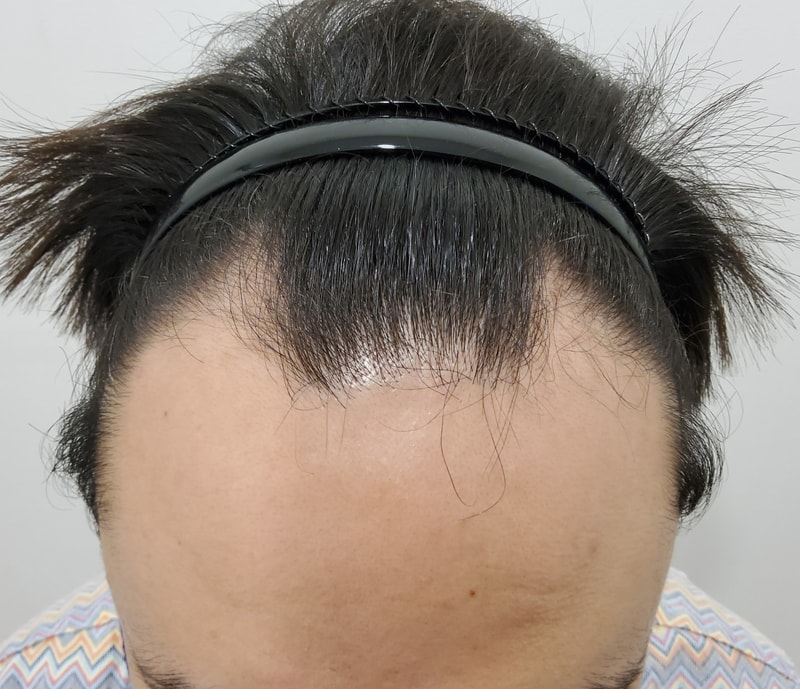 머리 다채워졌어요 