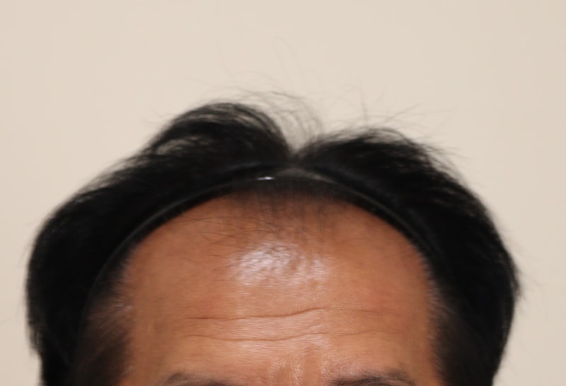 3개월차 후기입니다