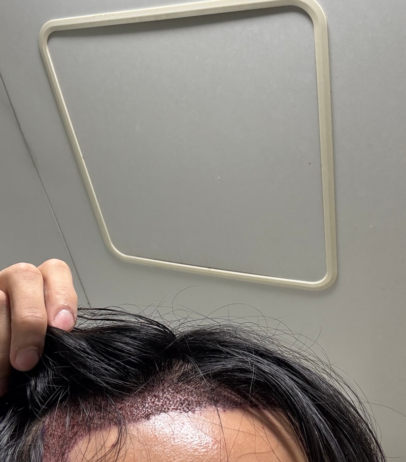 [자라다의원] 후기