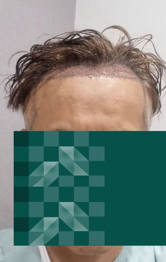 수술당일.jpg