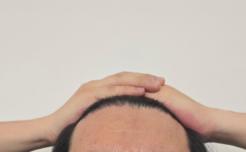 앞후.jpg