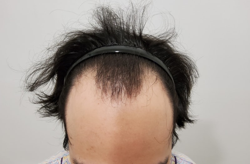 경과보러 3개월만에 한국왔습니다