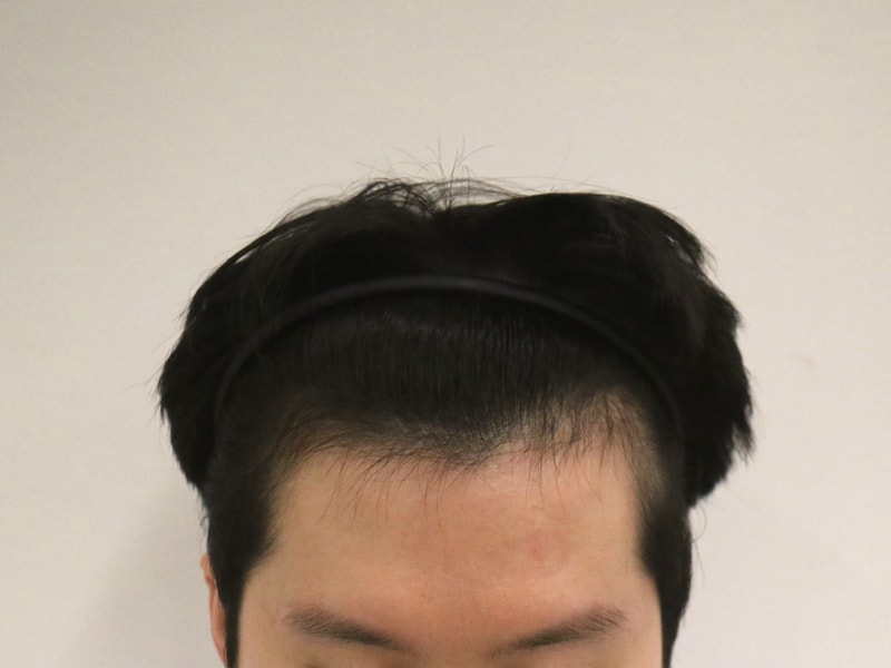 (2) 수술당일.jpg