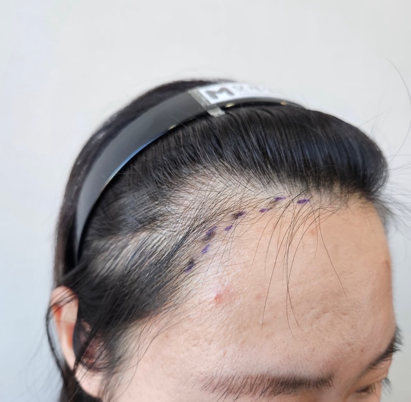 a review on the day of surgery
