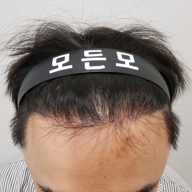 4. 수술후_6개월_2.jpg