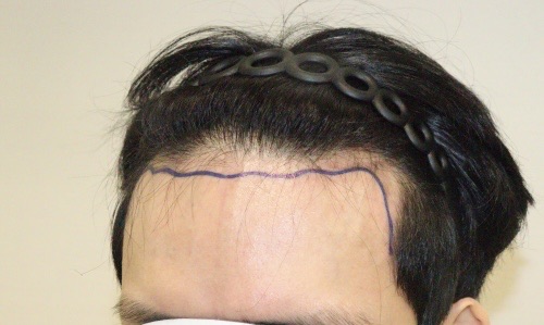 before.jpg